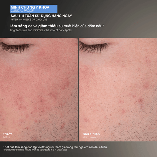 SKIN KITS SKIN KITS bộ đôi Bộ đôi tẩy da chết bán chạy nhất Daily Microfoliant ( 1 fullsize + 1 refill )