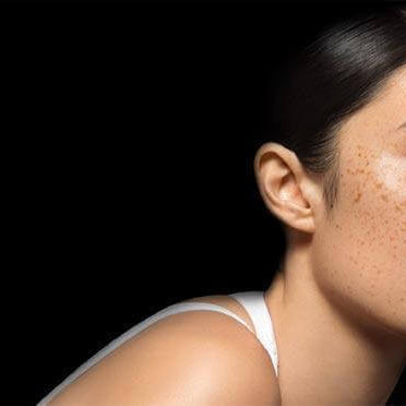 myths about oily skin