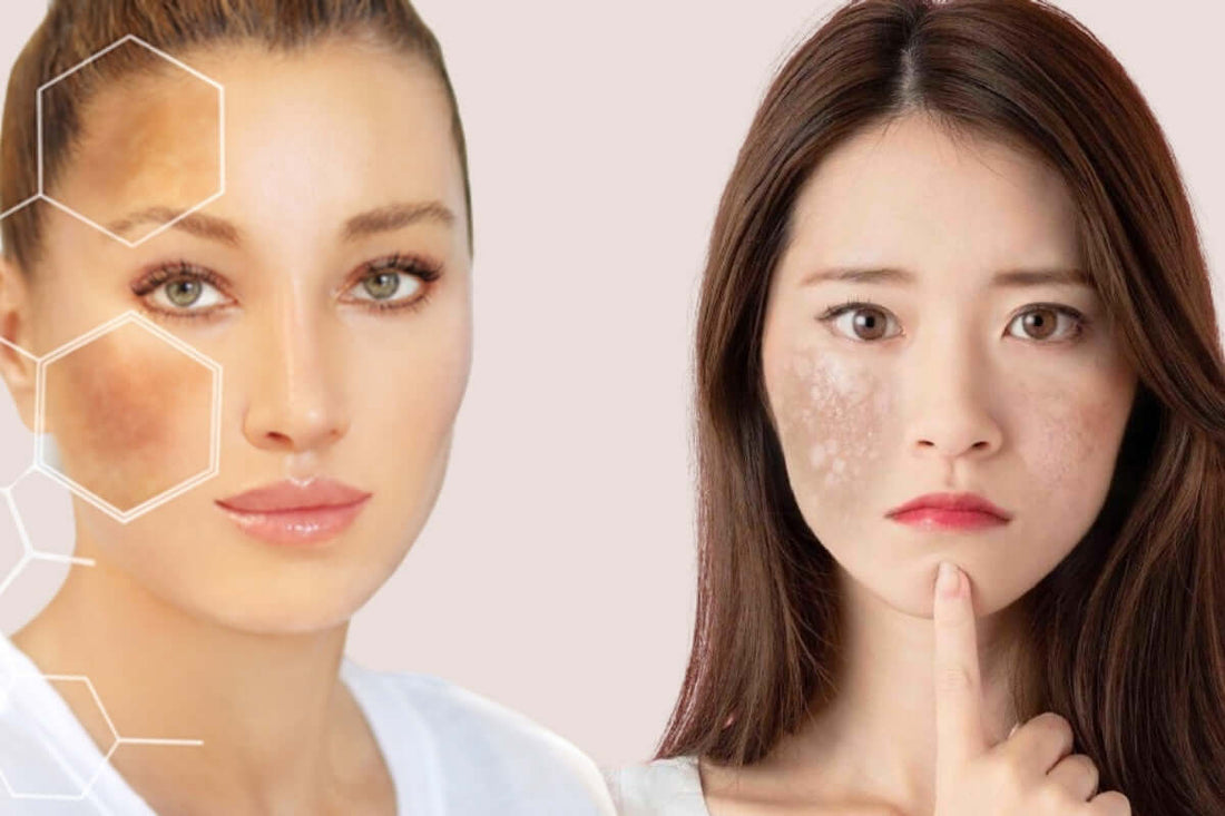 Dưỡng trắng da ban đêm cải thiện sắc tố da theo Dermalogica