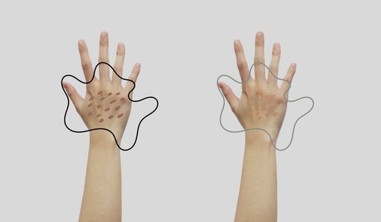 cach tri da tay bi sac to da hieu qua