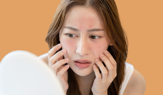 cach duong da phuc hoi da mong lo mao mach nhay cam kich ung