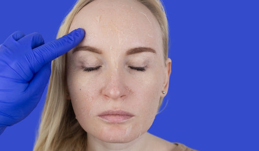 duong da nhay cam phuc hoi da mong yeu hu ton