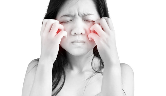 huong dan phuc hoi lam diu da bi di ung my pham hieu qua