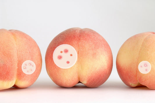 tai sao mong bi moc mun? cach tri moc mun o mong hieu qua nhat