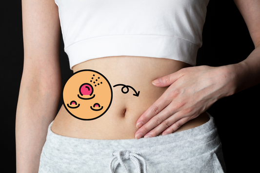 tai sao bung bi moc mun? cach tri mun moc o bung hieu qua tai nha