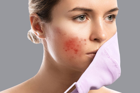 cach tri da bi break out nen lam gi hieu qua