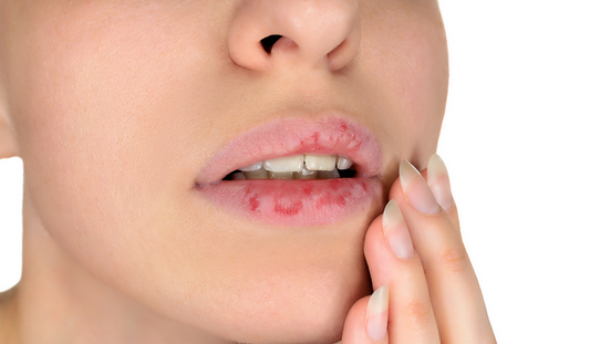 tai sao da moi bi bong troc? lot da moi nhieu co tot khong?