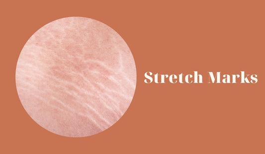 tai sao da bi ran? cach tri ran da hieu qua la gi?