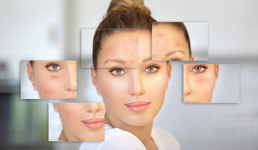 bi mun khong nen an gi? cach an uong cham soc da dep tu ben trong