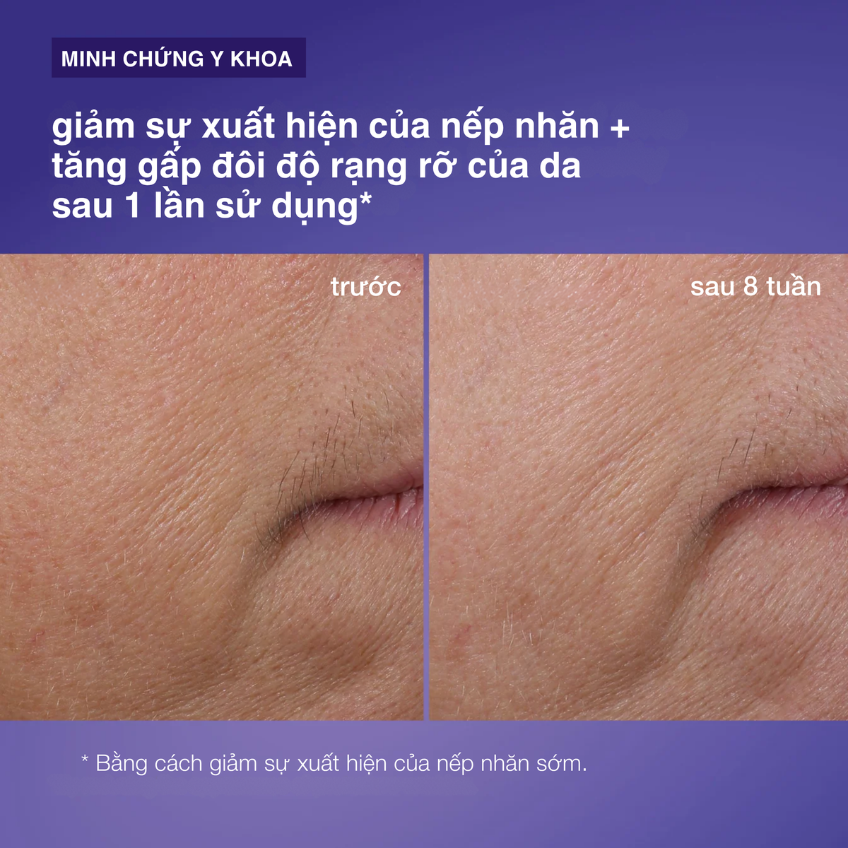 tinh chất săn chắc phyto nature firming serum