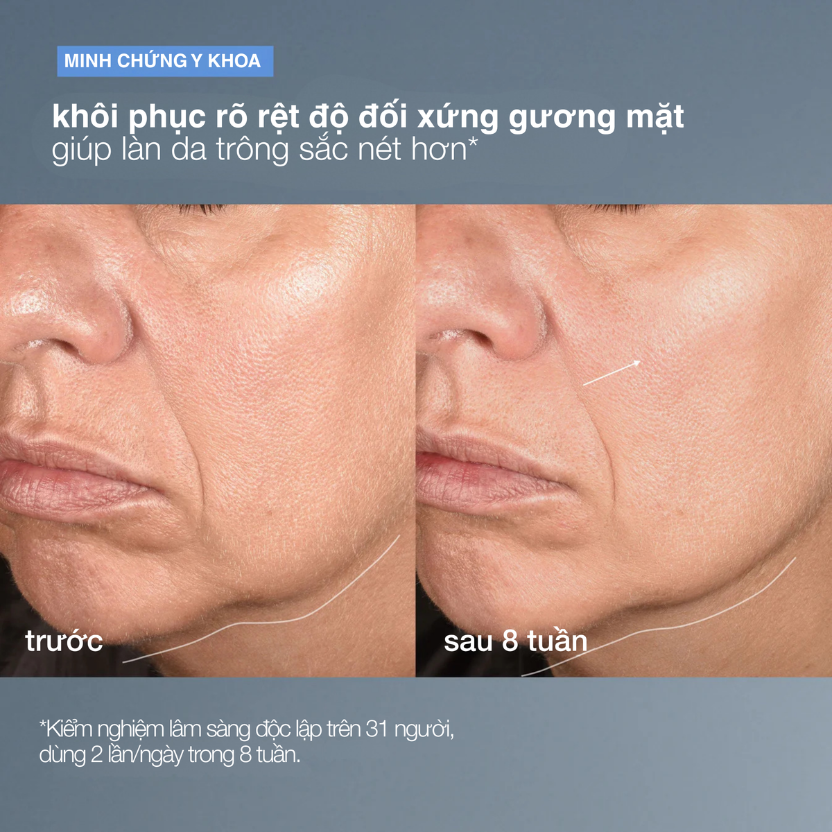 tinh chất săn chắc định hình neurotouch symmetry serum