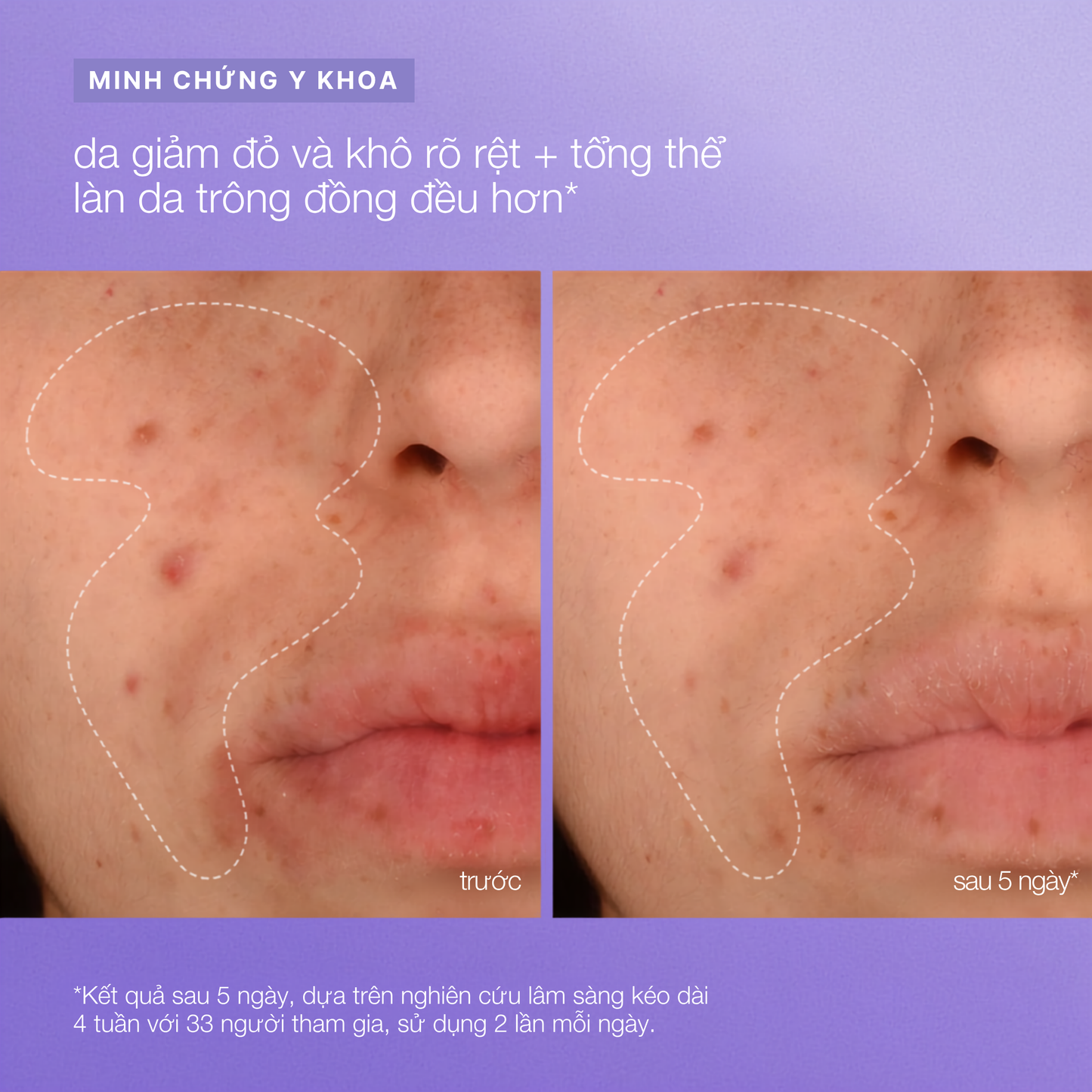 tinh chất phục hồi cho da mặt và toàn thân stabilizing repair serum