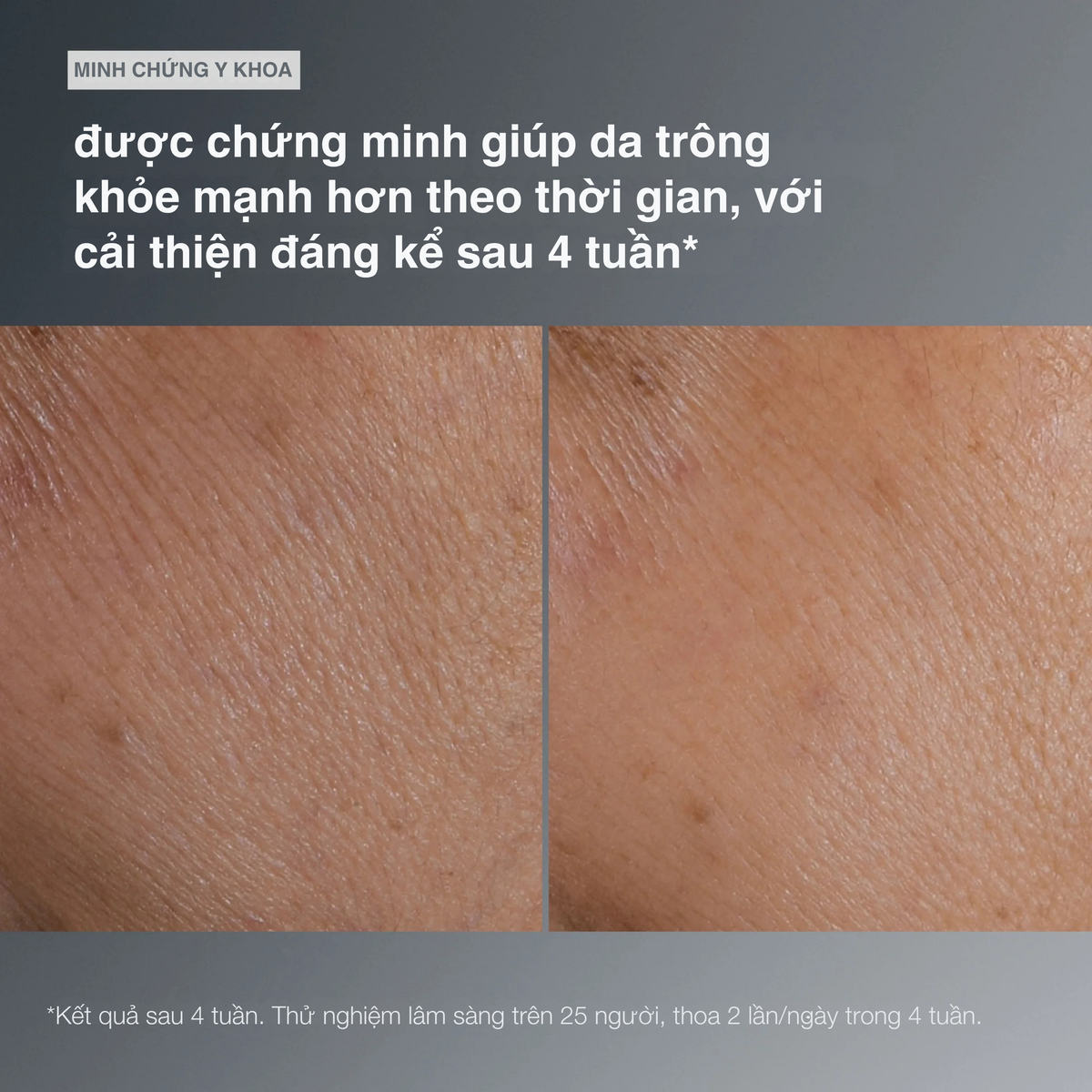 tinh chất 4 trong 1 smart response serum