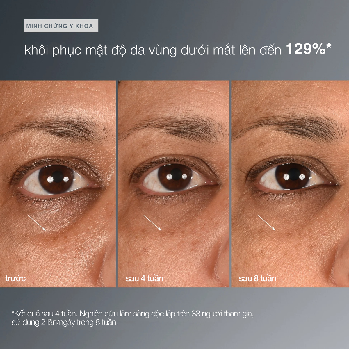 tinh chất vùng da dướii mắt smart eye density