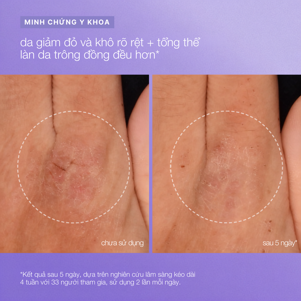 tinh chất phục hồi cho da mặt và toàn thân stabilizing repair serum