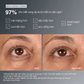 tinh chất vùng da dướii mắt smart eye density