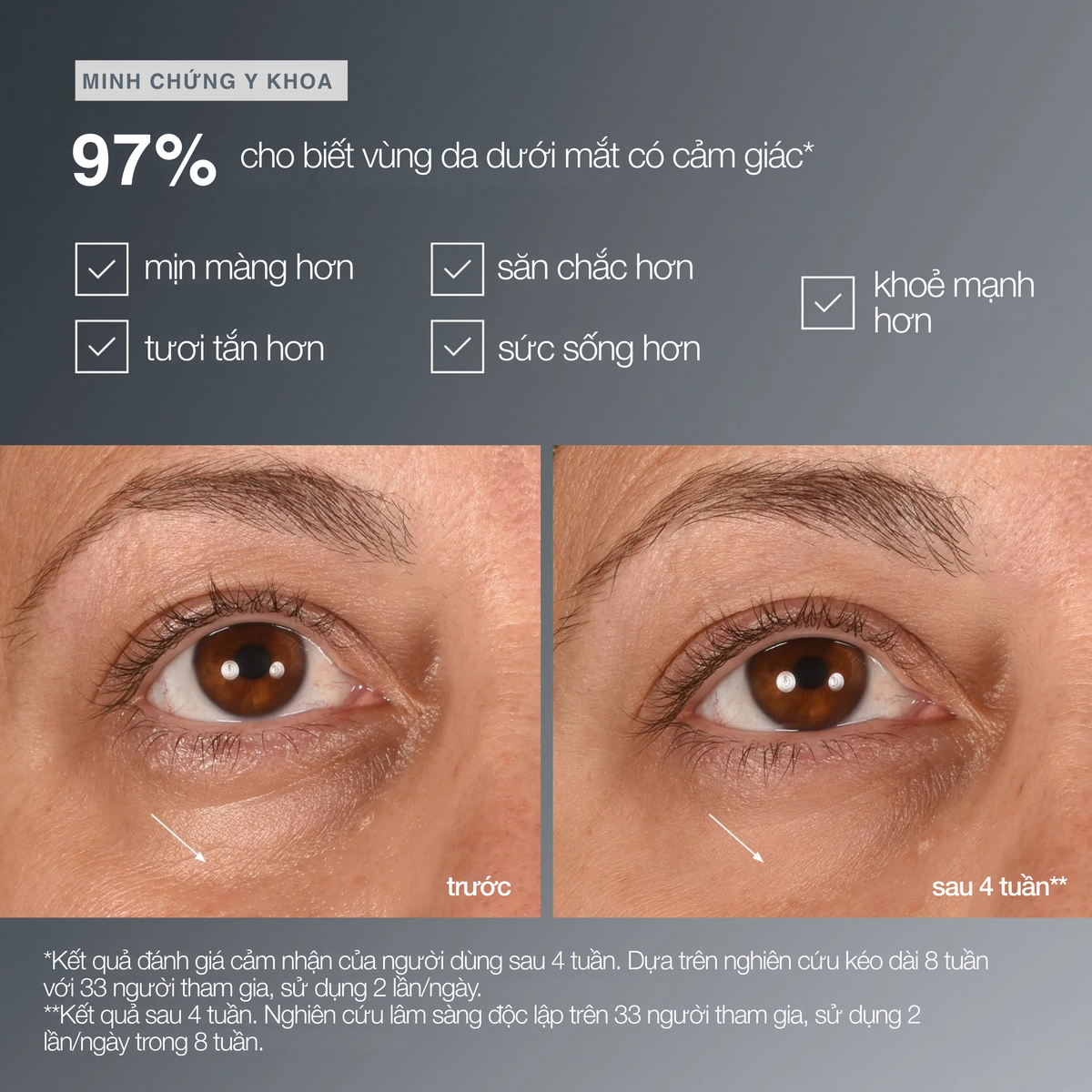 tinh chất vùng da dướii mắt smart eye density