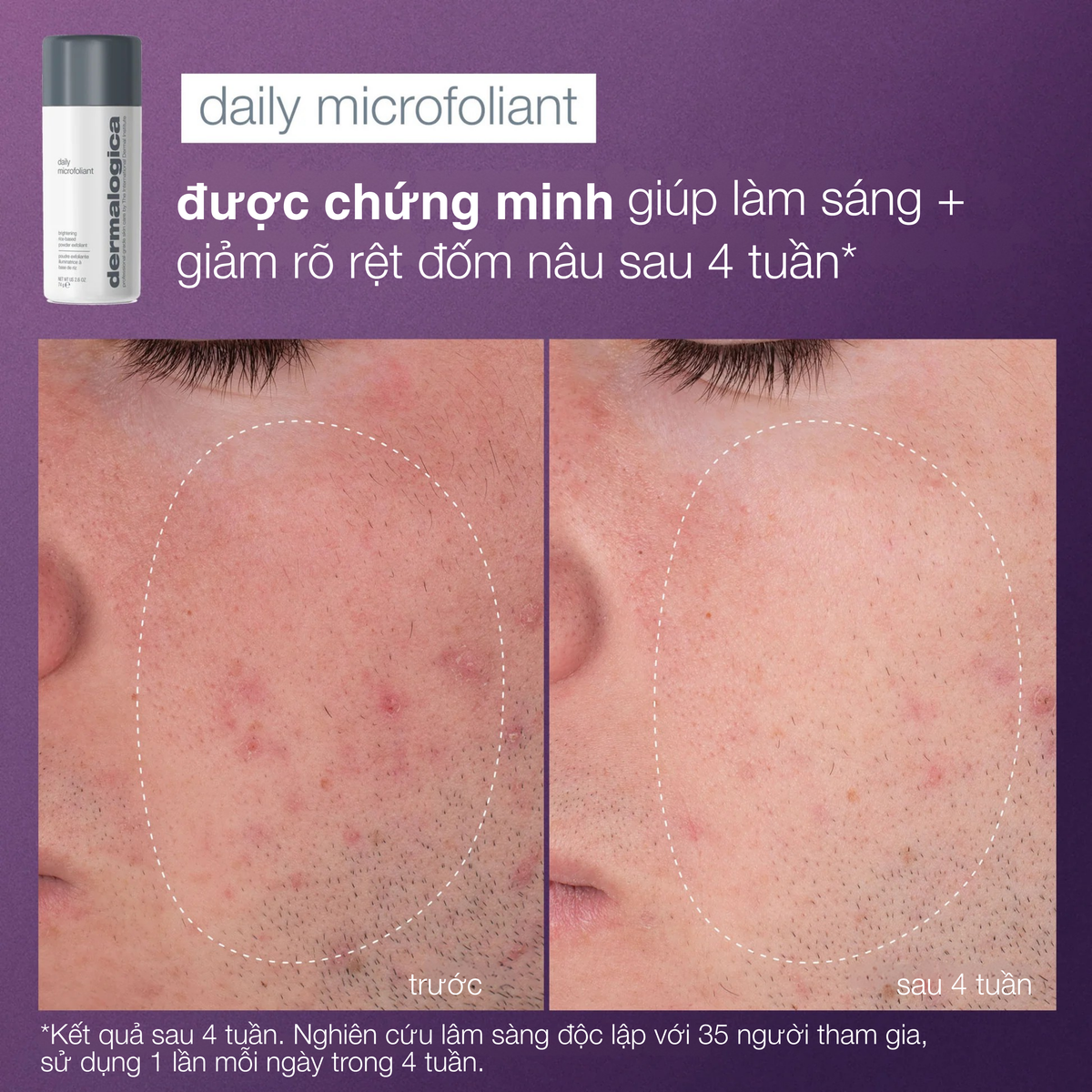 Chuyên gia làm sạch + rạng rỡ (3 full-sizes)