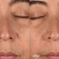 Dermalogica Vietnam 45 phút melanopro peel system treatment