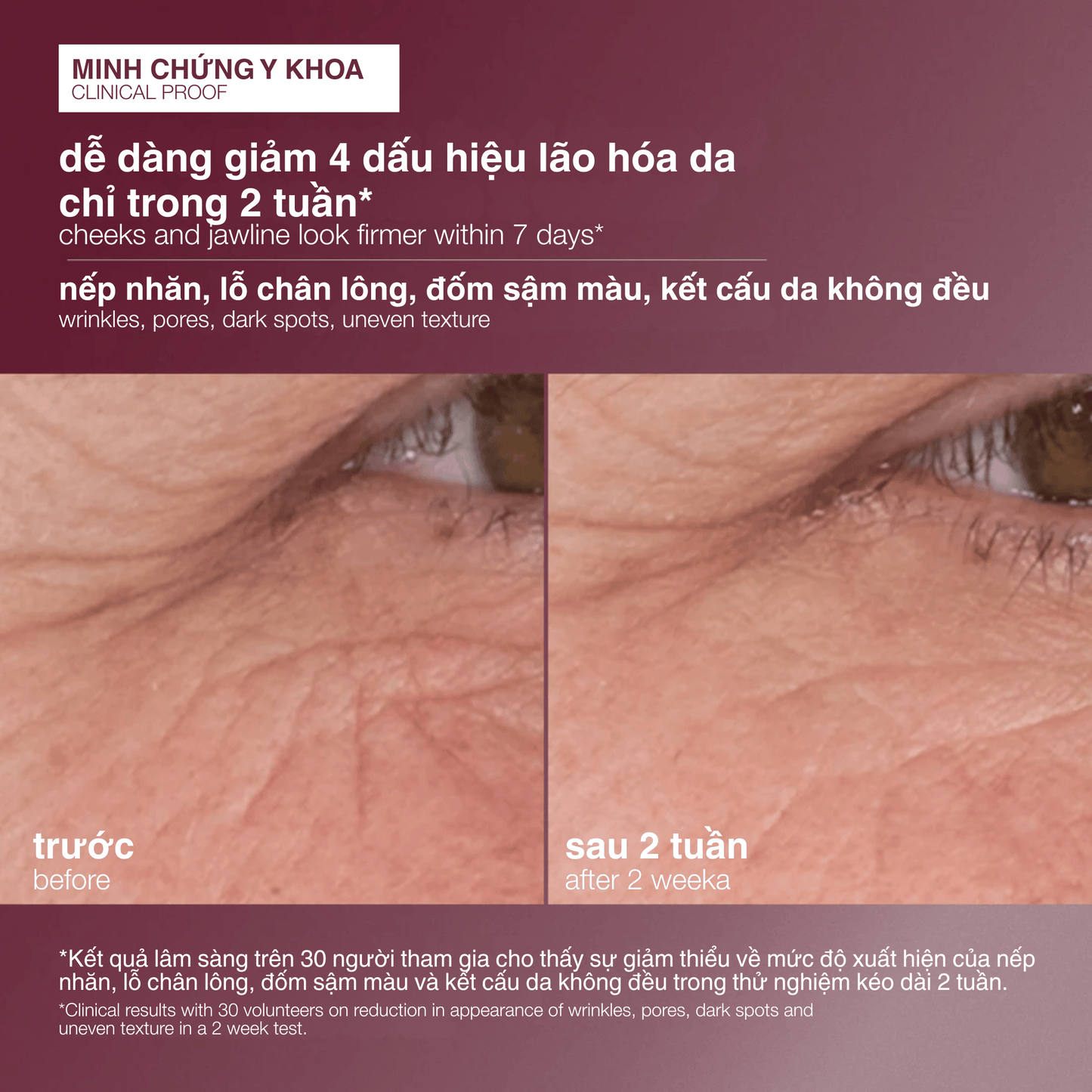 Dermalogica Vietnam TARGETED TREATMENTS tinh chất retinol 3,5% dynamic skin retinol serum