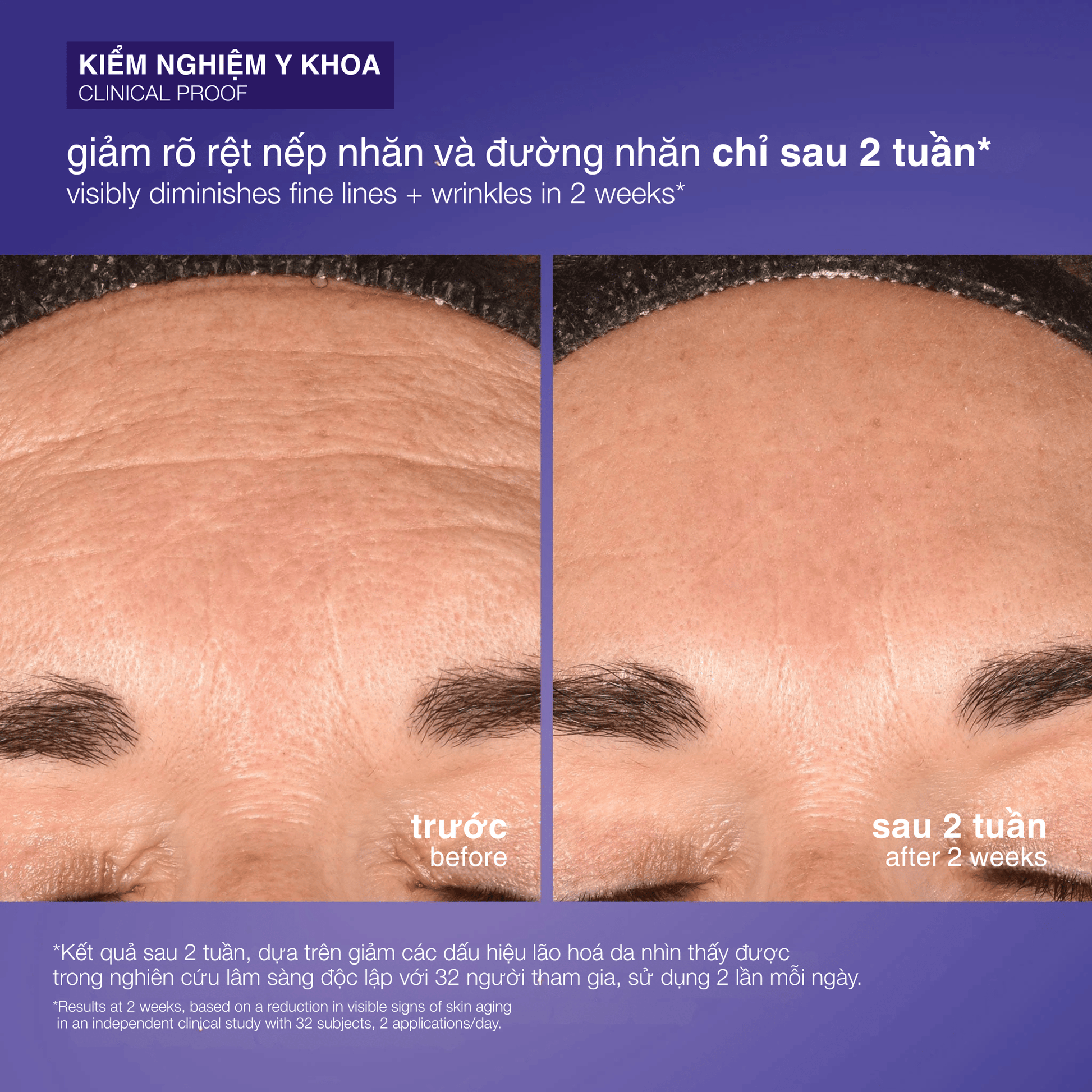 EXFOLIANTS EXFOLIANTS 100ml tái tạo da chứa exosome phyto nature e2