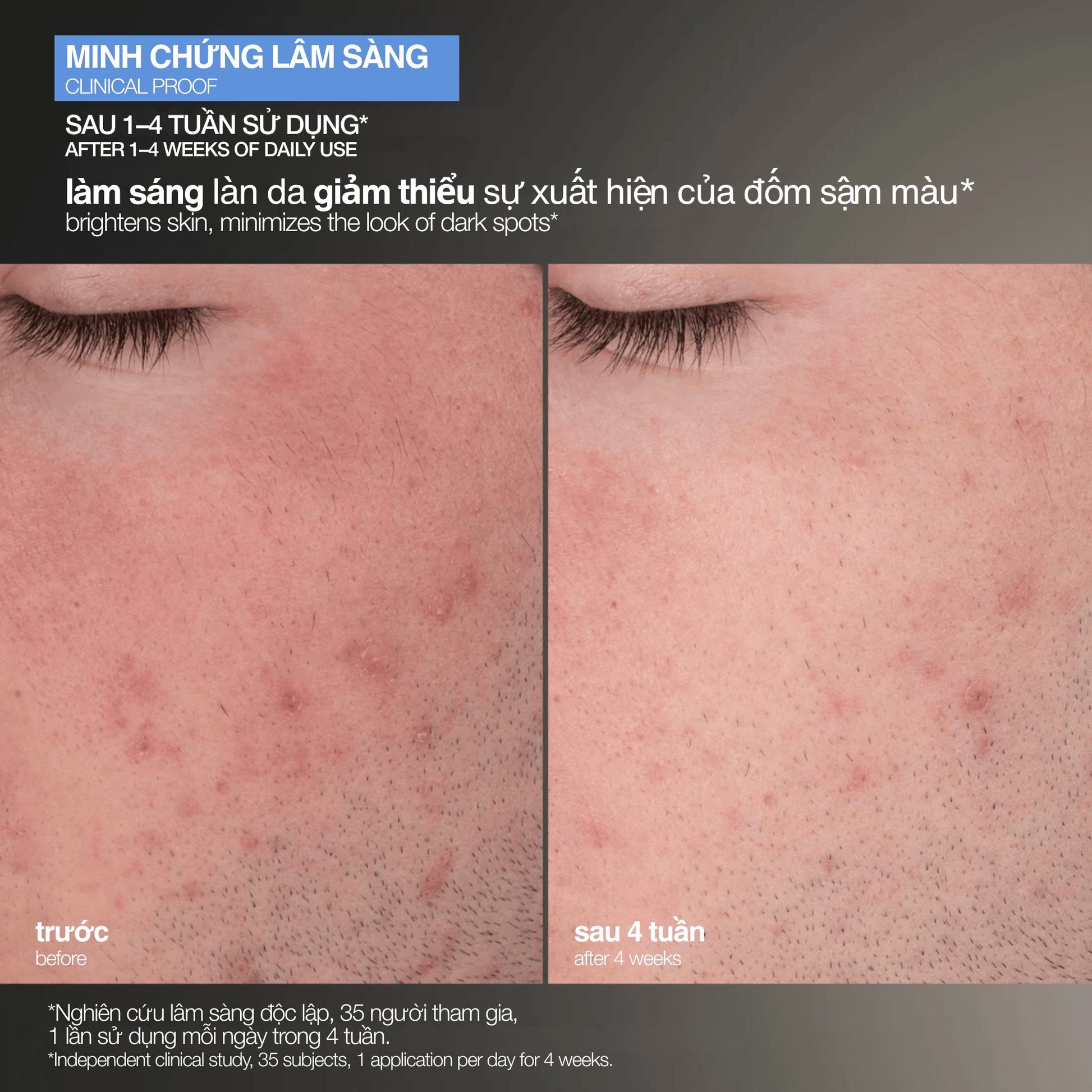 EXFOLIANTS EXFOLIANTS tẩy da chết cám gạo daily microfoliant