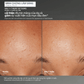 EXFOLIANTS EXFOLIANTS tẩy da chết cám gạo daily microfoliant