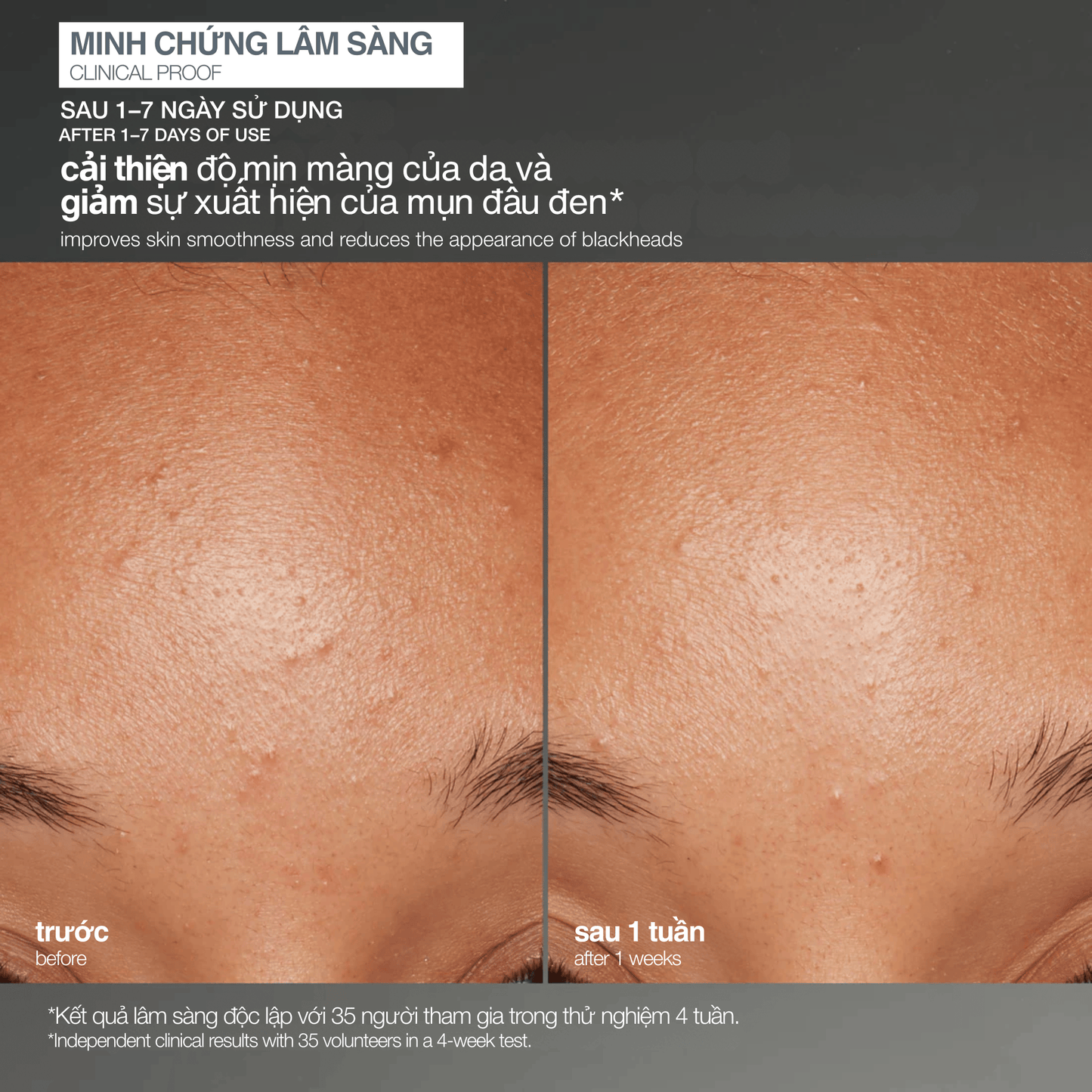 EXFOLIANTS EXFOLIANTS tẩy da chết cám gạo daily microfoliant