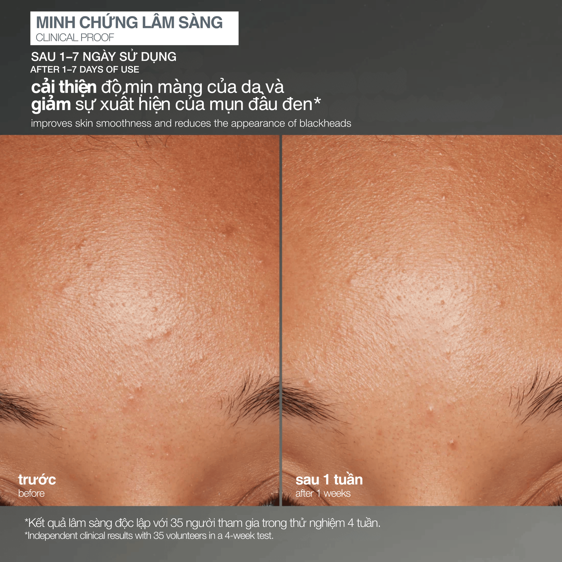 EXFOLIANTS EXFOLIANTS tẩy da chết cám gạo daily microfoliant