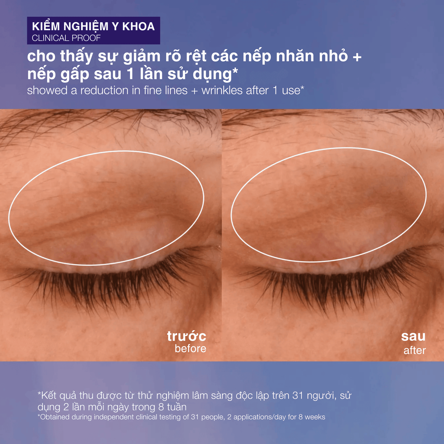 EYE TREATMENTS EYE TREATMENTS 15ml kem mắt săn chắc phyto nature lifting eye cream