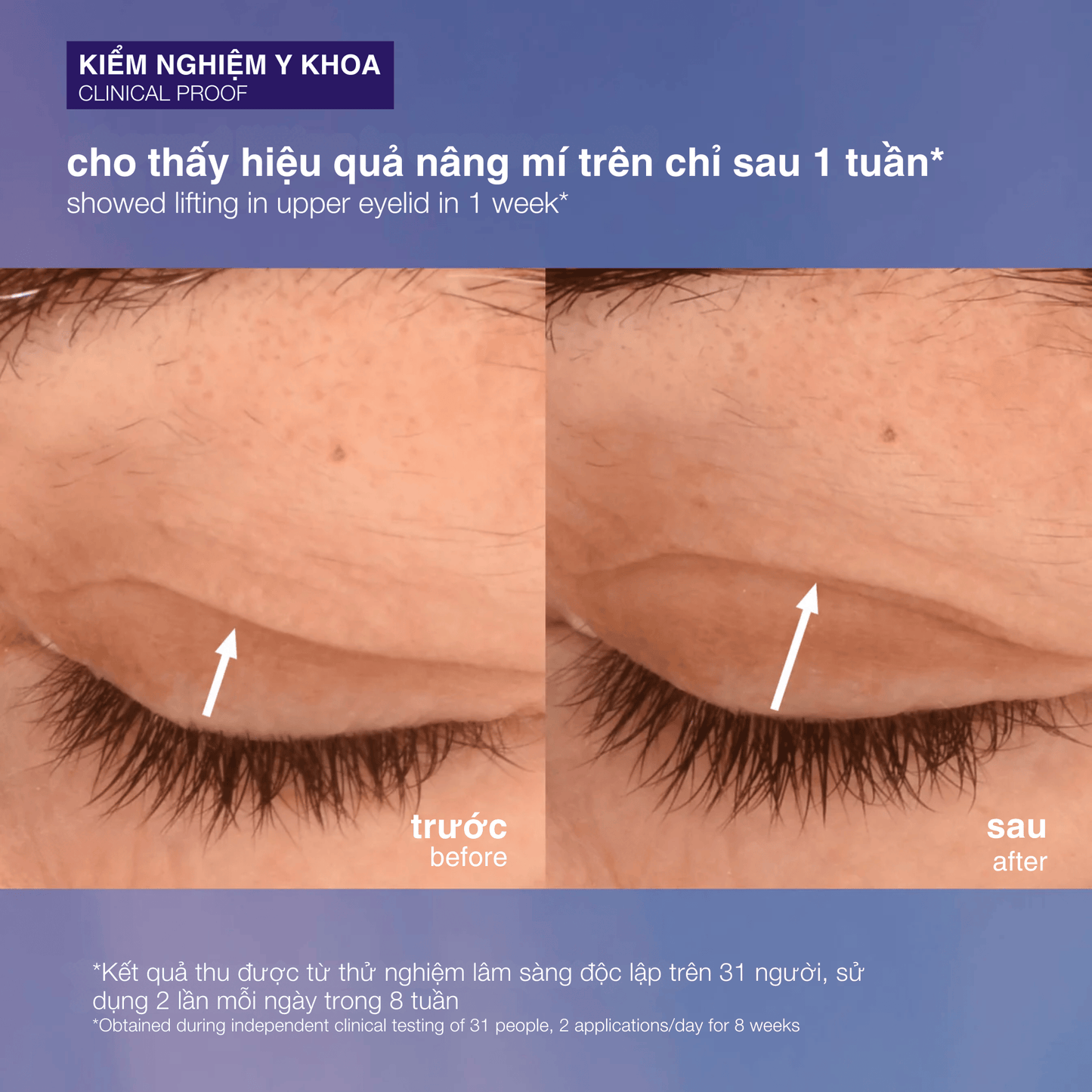 EYE TREATMENTS EYE TREATMENTS 15ml kem mắt săn chắc phyto nature lifting eye cream