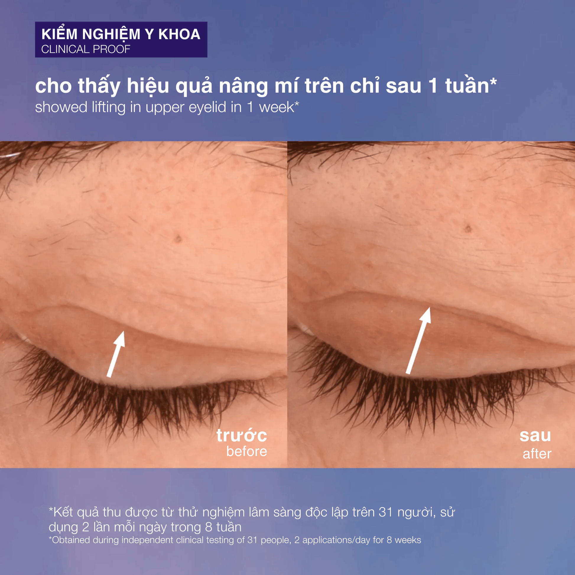 EYE TREATMENTS EYE TREATMENTS 15ml kem mắt săn chắc phyto nature lifting eye cream