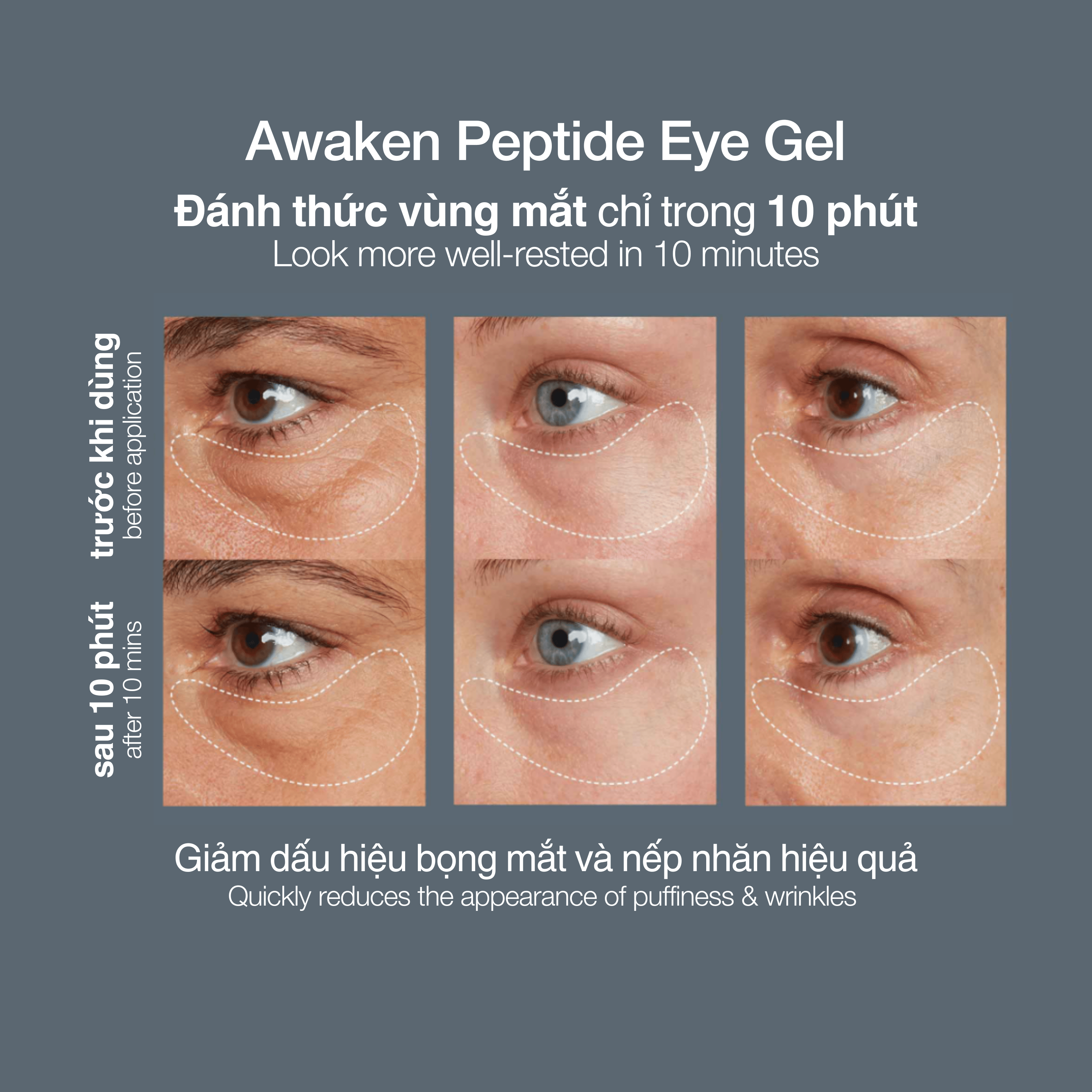 EYE TREATMENTS EYE TREATMENTS awaken peptide depuffing eye gel 15ml