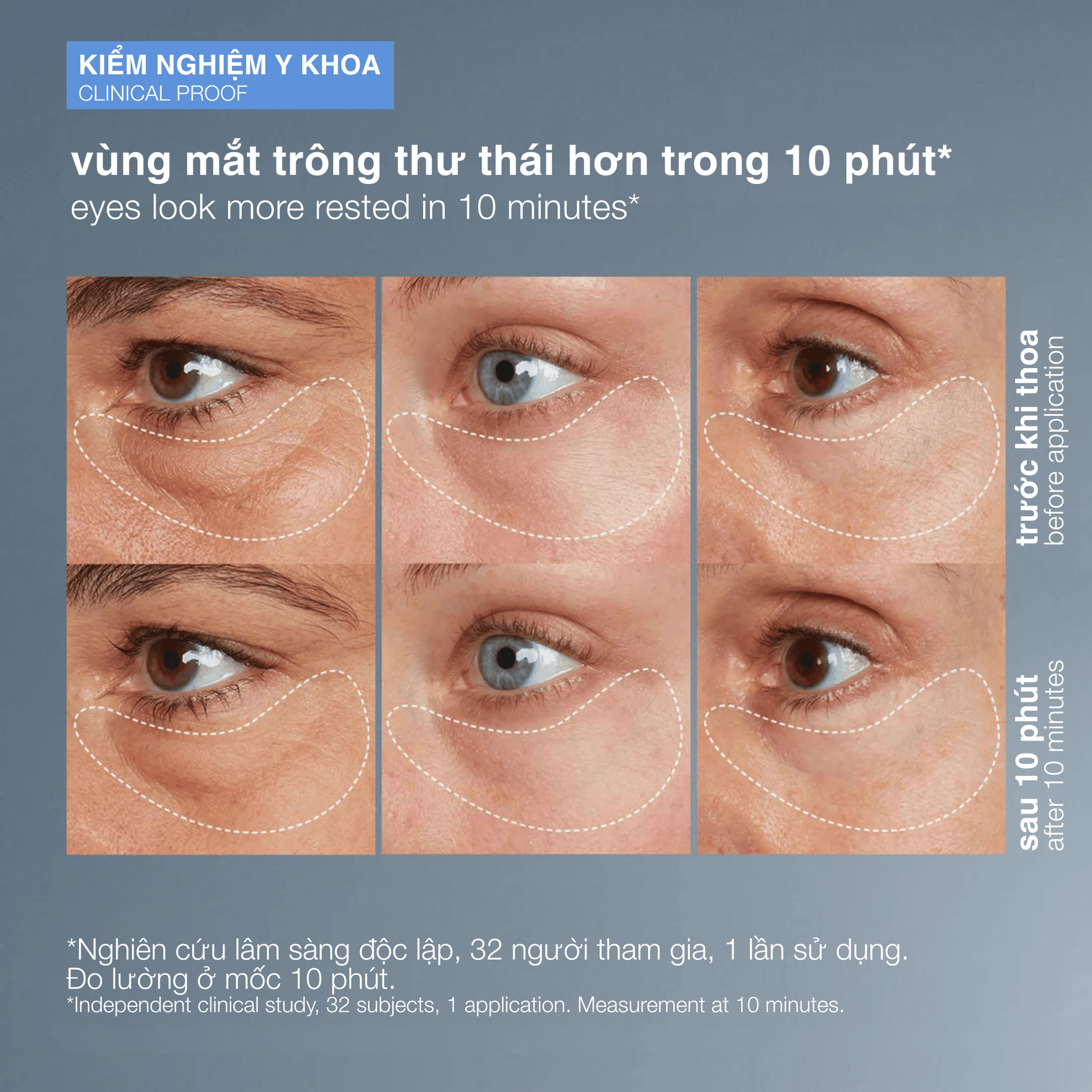 EYE TREATMENTS EYE TREATMENTS Fullsize 15ml gel giảm bọng thâm mắt awaken peptide eye gel