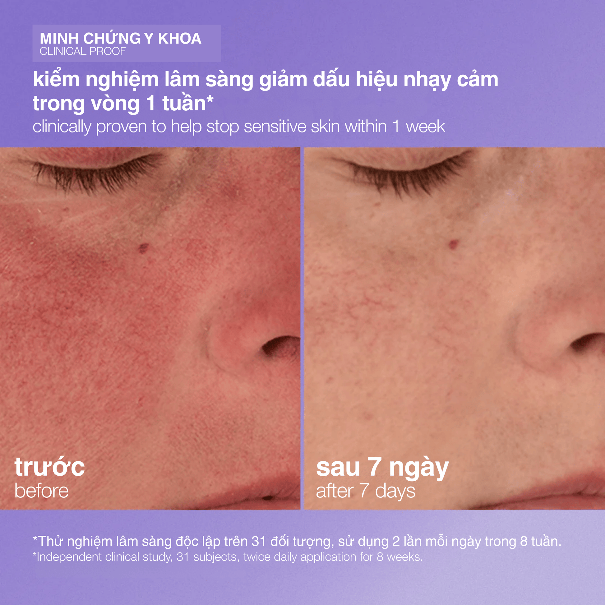 MOISTURIZERS MOISTURIZERS 50ml kem đặc trị da tổn thương stabilizing repair cream