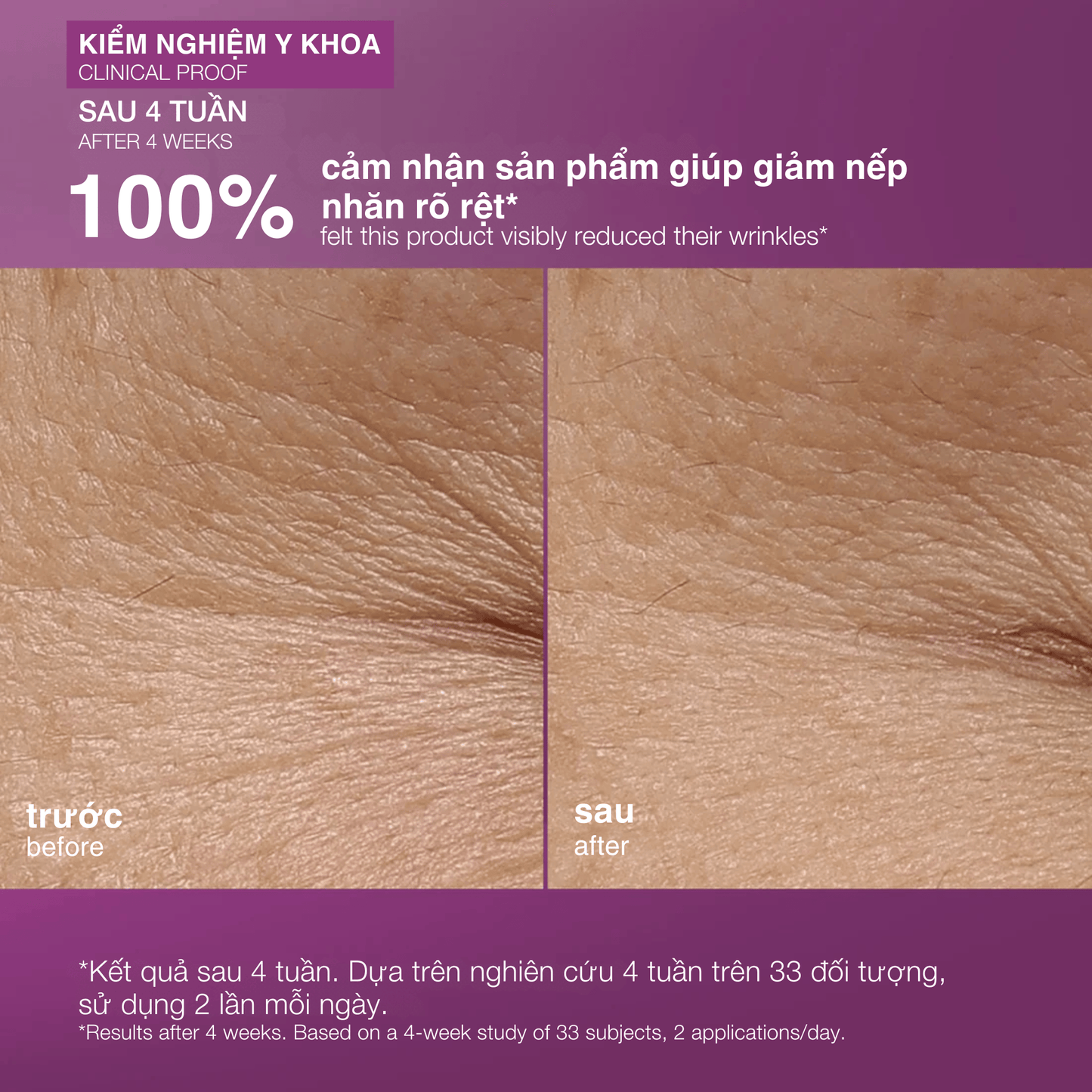 MOISTURIZERS MOISTURIZERS 50ml kem dưỡng cho da căng thẳng multivitamin power recovery cream