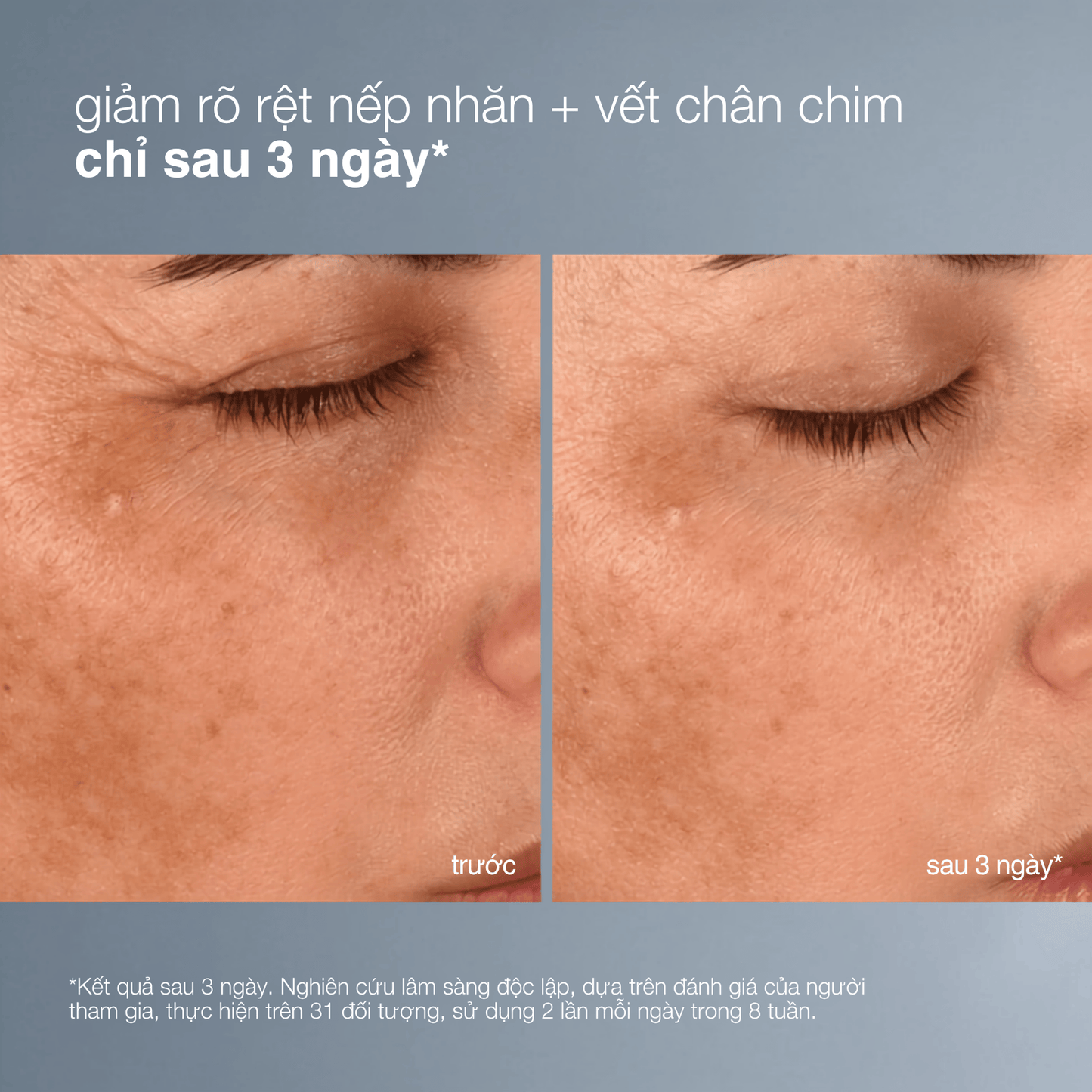 MOISTURIZERS MOISTURIZERS Fullsize 50ml kem dưỡng pro-collagen banking water cream (đặt hàng trước)