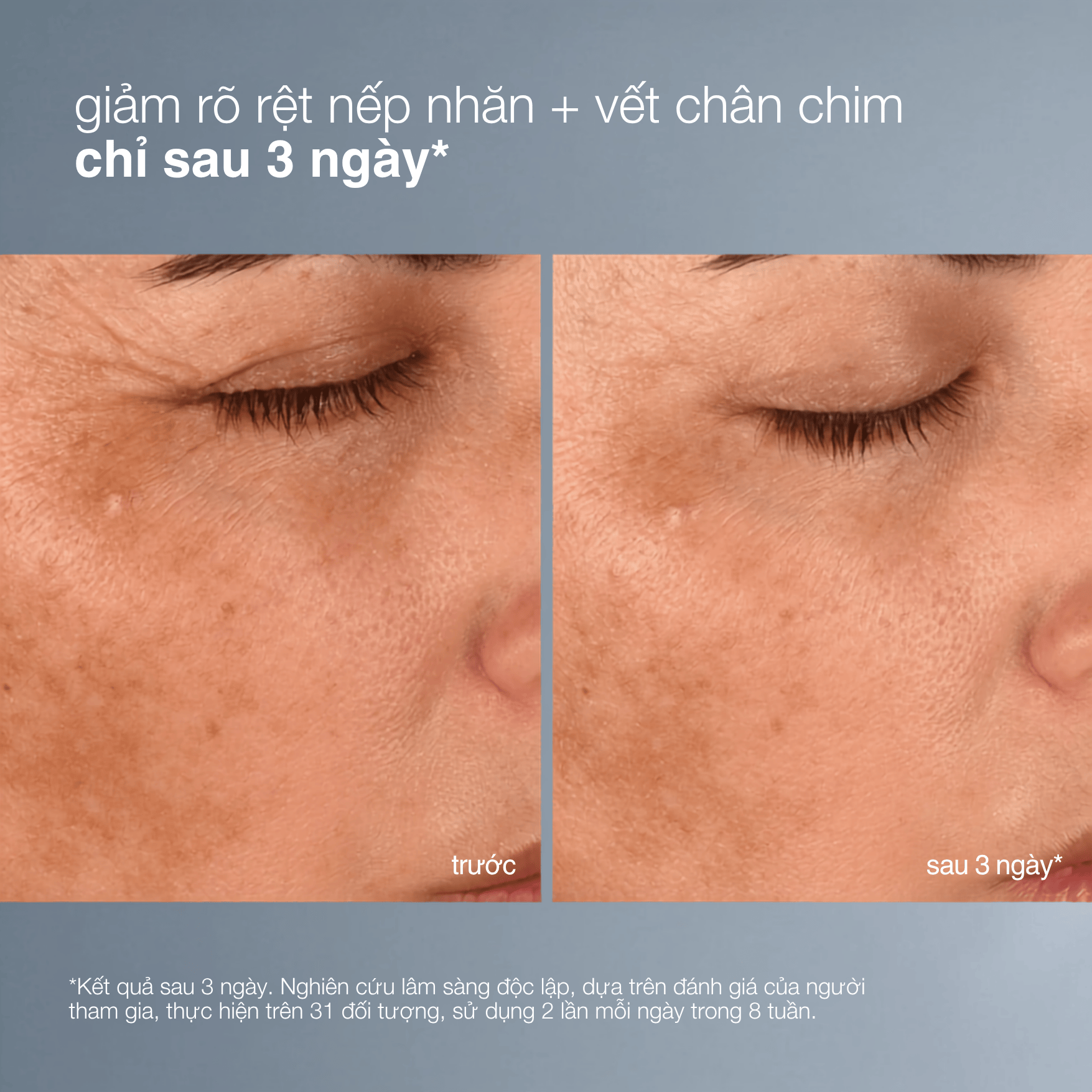 MOISTURIZERS MOISTURIZERS Fullsize 50ml kem dưỡng pro-collagen banking water cream (đặt hàng trước)