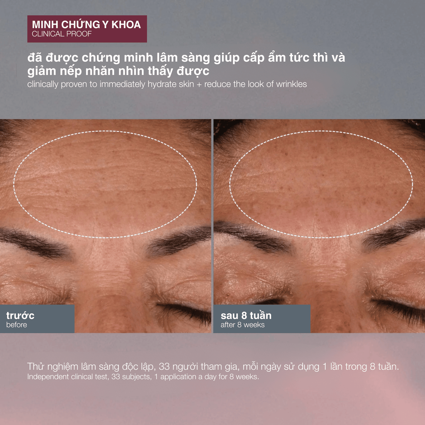 MOISTURIZERS MOISTURIZERS kem dưỡng chống nắng chống lão hoá dynamic skin recovery spf50