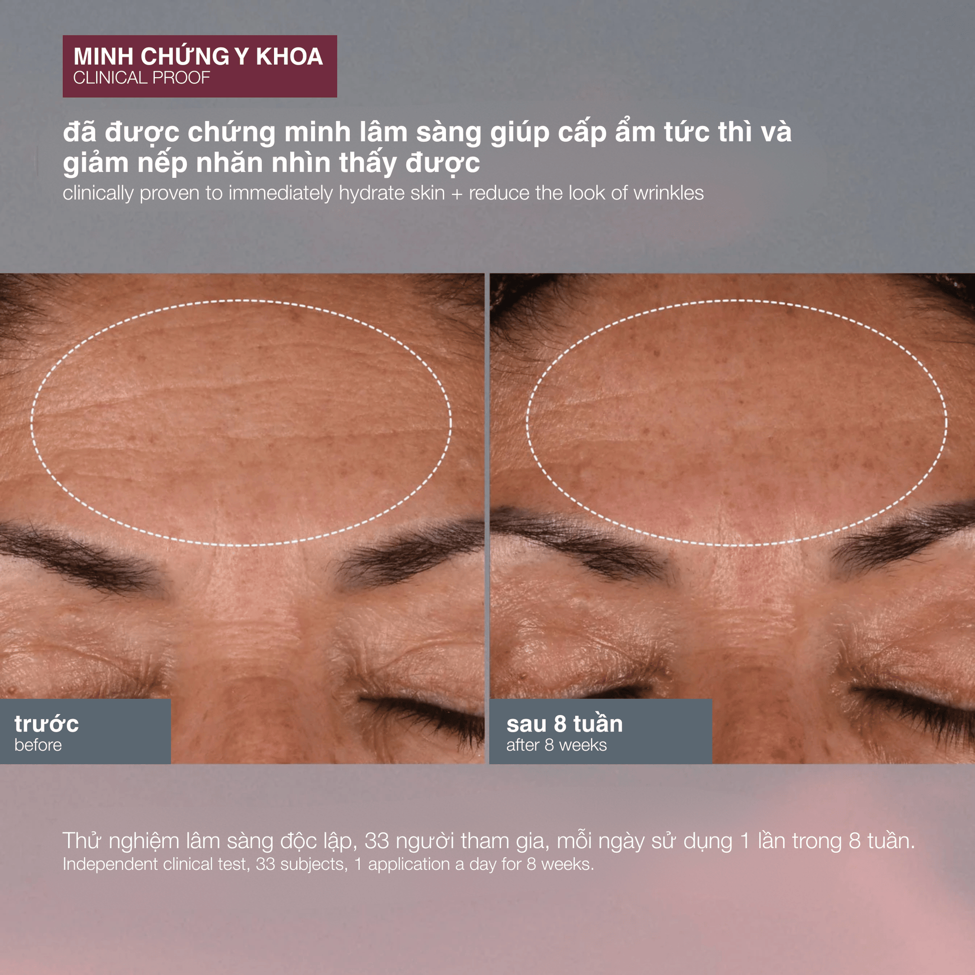 MOISTURIZERS MOISTURIZERS kem dưỡng chống nắng chống lão hoá dynamic skin recovery spf50