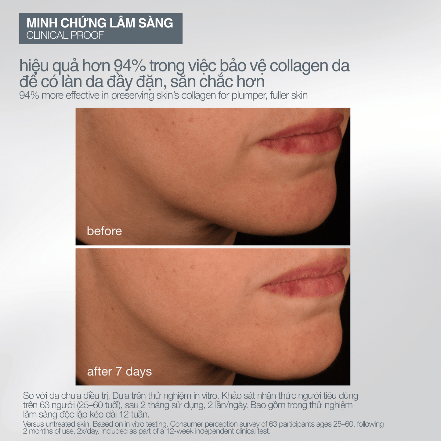 SKIN KITS SKIN KITS bộ sản phẩm Bộ mùa lễ hội 2025 khoảnh khắc chuyên gia