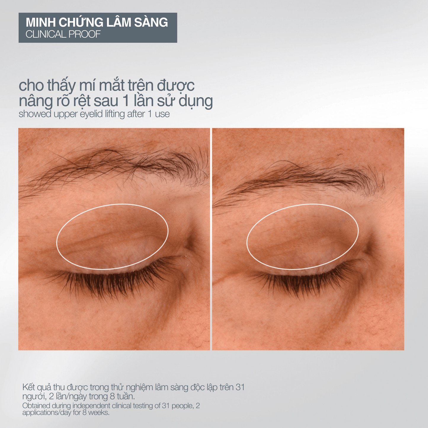 SKIN KITS SKIN KITS bộ sản phẩm Bộ mùa lễ hội 2025 khoảnh khắc chuyên gia