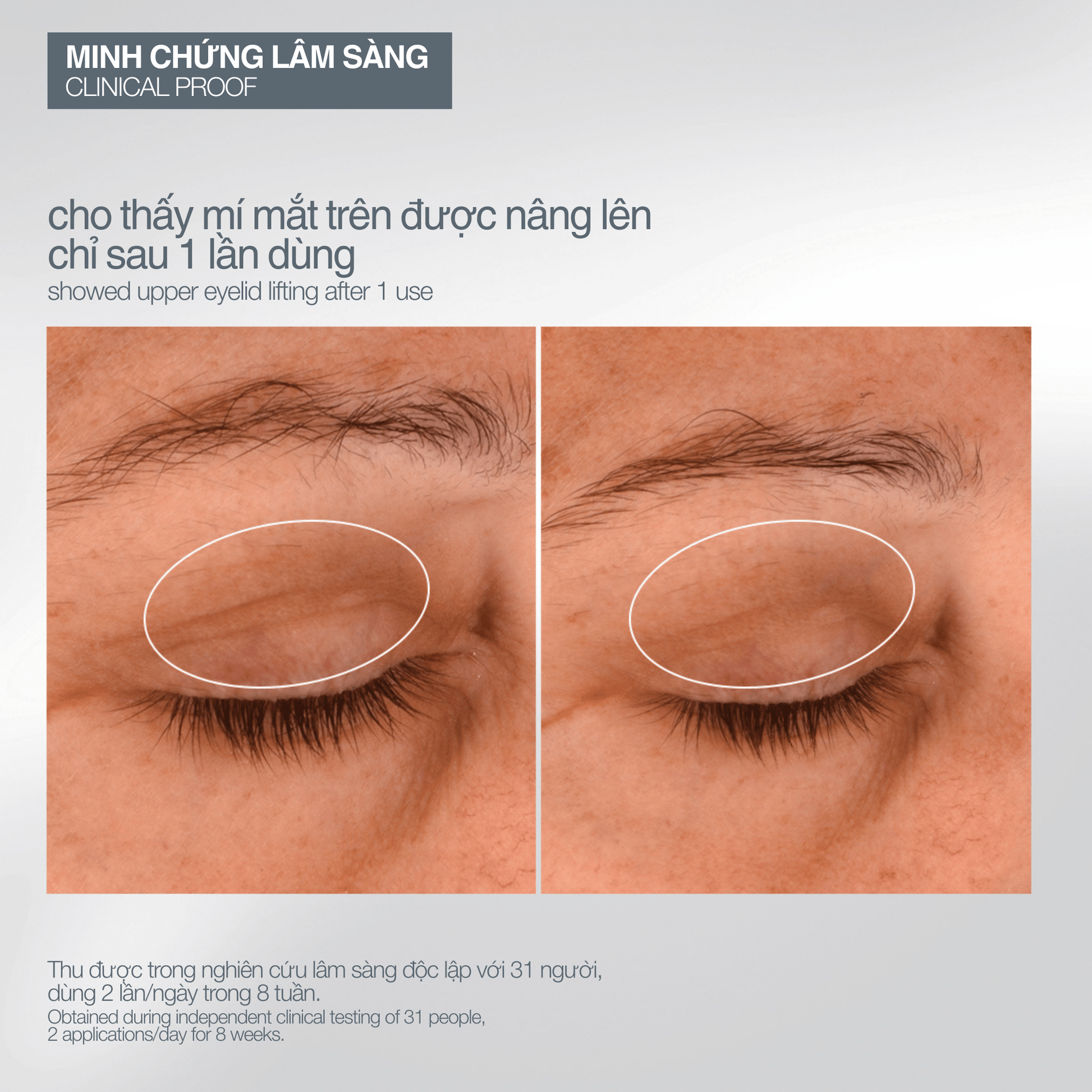 SKIN KITS SKIN KITS bộ sản phẩm Bộ mùa lễ hội 2025 khoảnh khắc tự nhiên