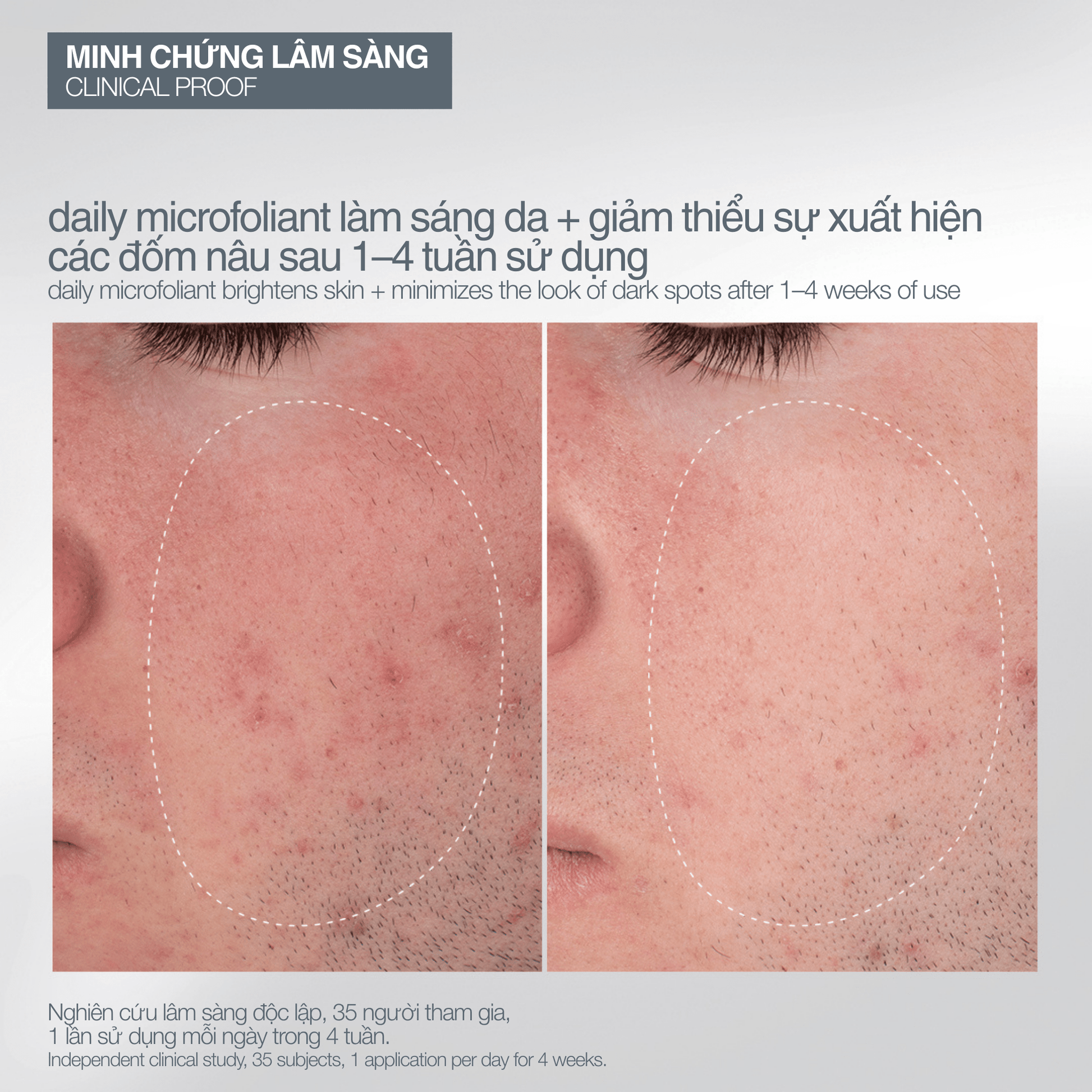 SKIN KITS SKIN KITS bộ sản phẩm Bộ mùa lễ hội 2025 niềm vui nhỏ bé