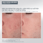SKIN KITS SKIN KITS bộ sản phẩm Bộ mùa lễ hội 2025 toả sáng mọi ánh nhìn