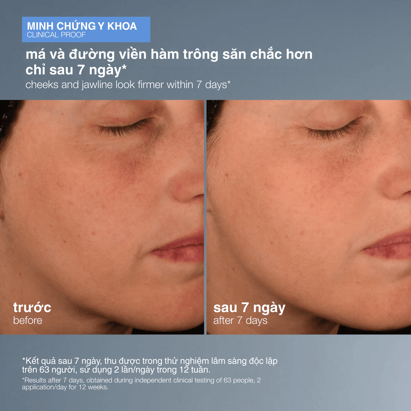 TARGETED TREATMENTS TARGETED TREATMENTS tinh chất duy trì collagen pro-collagen banking serum