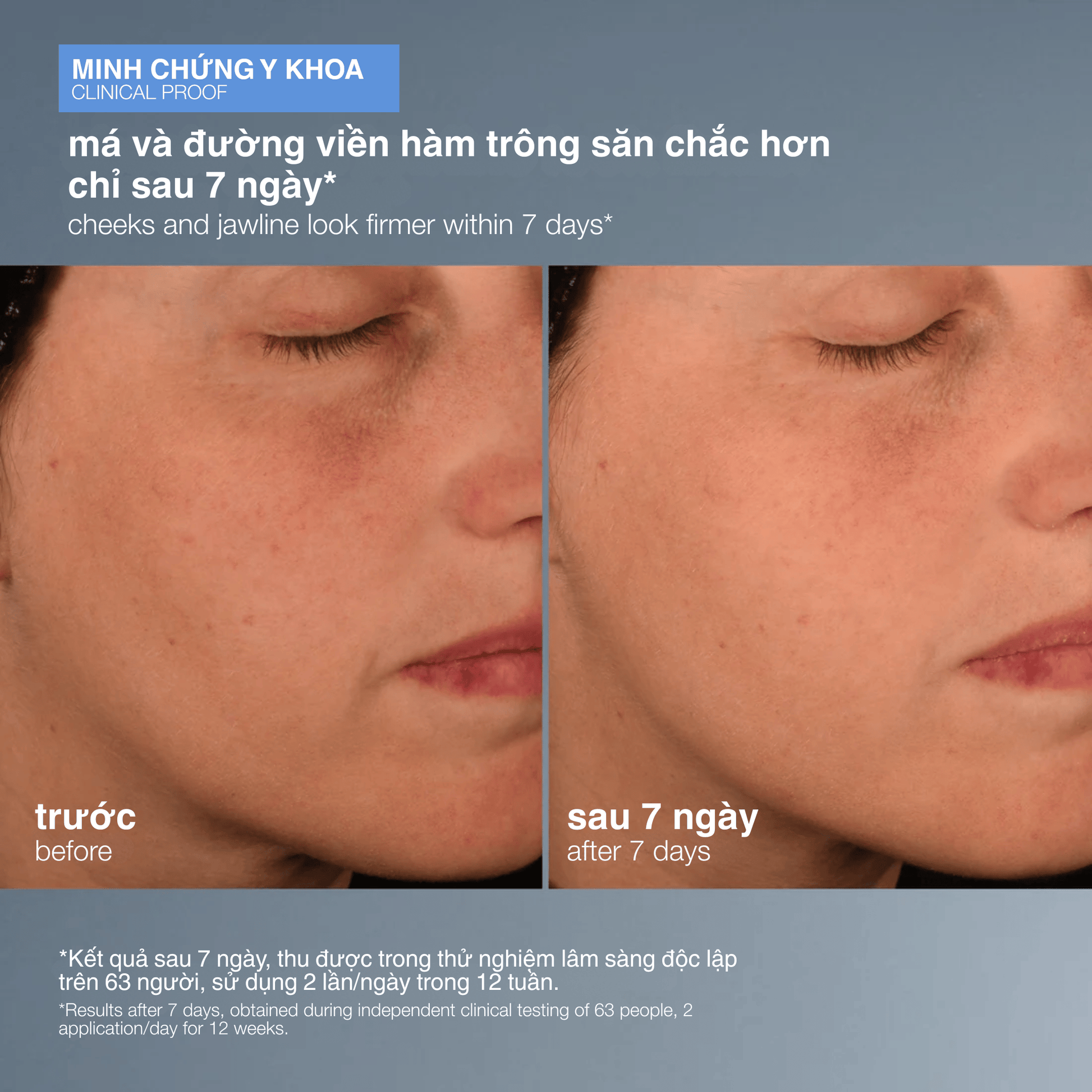 TARGETED TREATMENTS TARGETED TREATMENTS tinh chất duy trì collagen pro-collagen banking serum